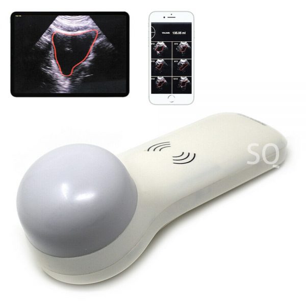 Portable Bladder Probe Scanner - Ultrasound